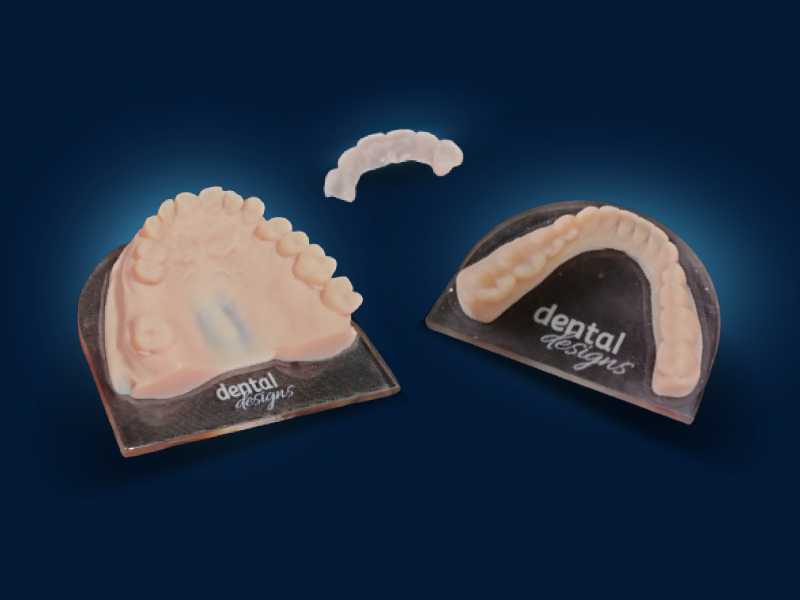 Pushing The Boundaries Of Digital Dentistry With Stratasys Dental 3D ...